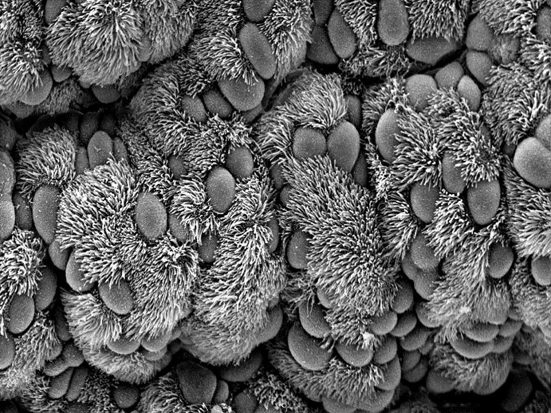 Scanning electron micrograph of ciliated and nonciliated cells lining the bronchiole of the respiratory tract